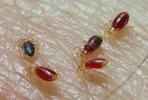 Punaise des lits (Cimex lectularius), jeunes larves attablées sur mon bras.