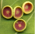 autres galles lenticulaires