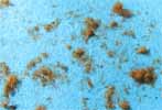 Processionnaire du pin (Thaumetopoea pityocampa) poils urticants isoles, photo 1.