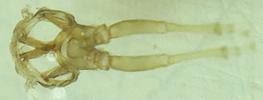 Psylle de l'éléagnus  ou psylle du chalef (Cacopsylla fulguralis)  "squelette" des pattes postérieures, photo 2.